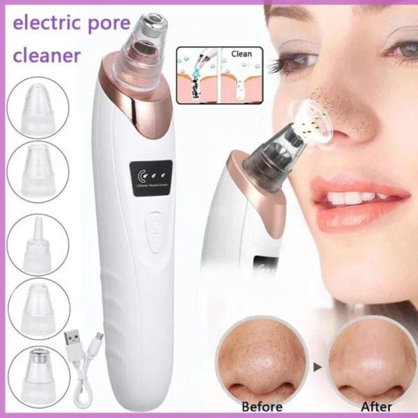 Face Vacuum Suction Blackhead Remover Pore Cleaner | Electric Deep Cleansing Tool for Nose & Face - Image 2